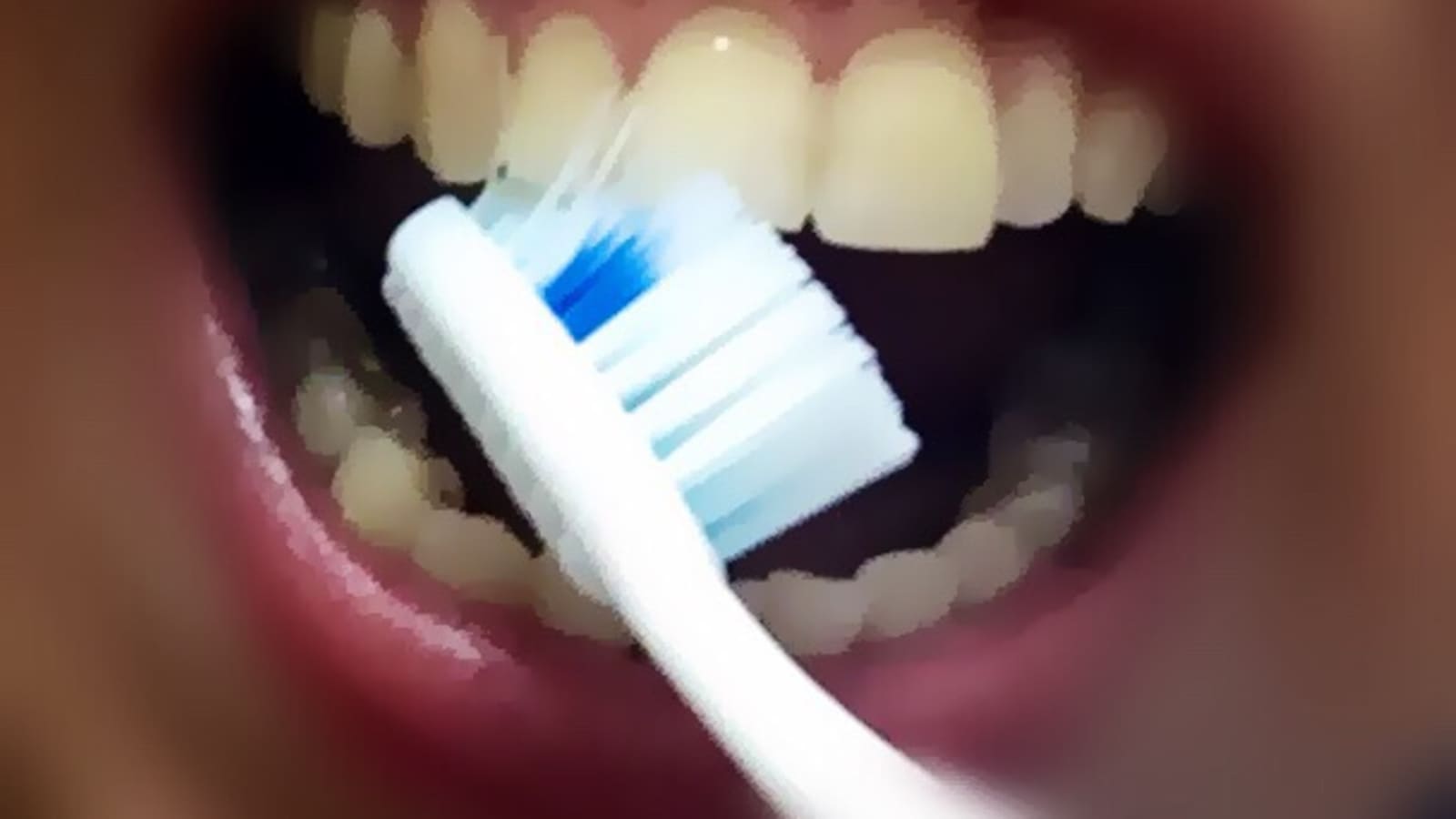 Dentální hygiena Brno